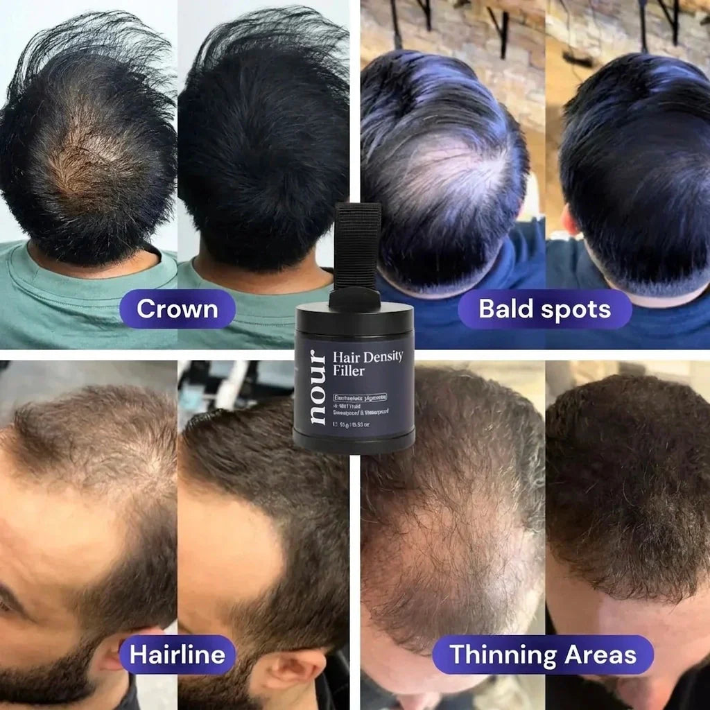 Hair density filler powder, demonstrating effective coverage for a receding hairline, crown, bald spots, and thinning areas