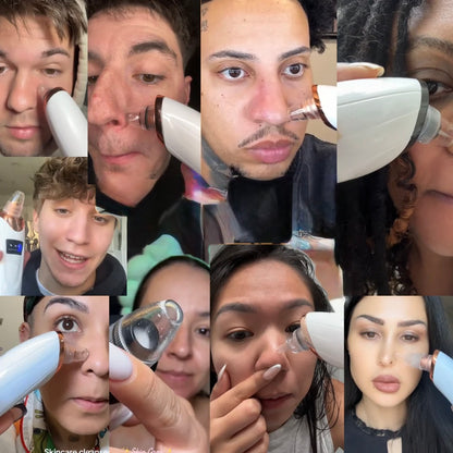 Blackhead Remover Pore Vacuum Cleaner