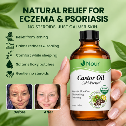 100% Pure Organic Castor Oil for Eczema & Psoriasis