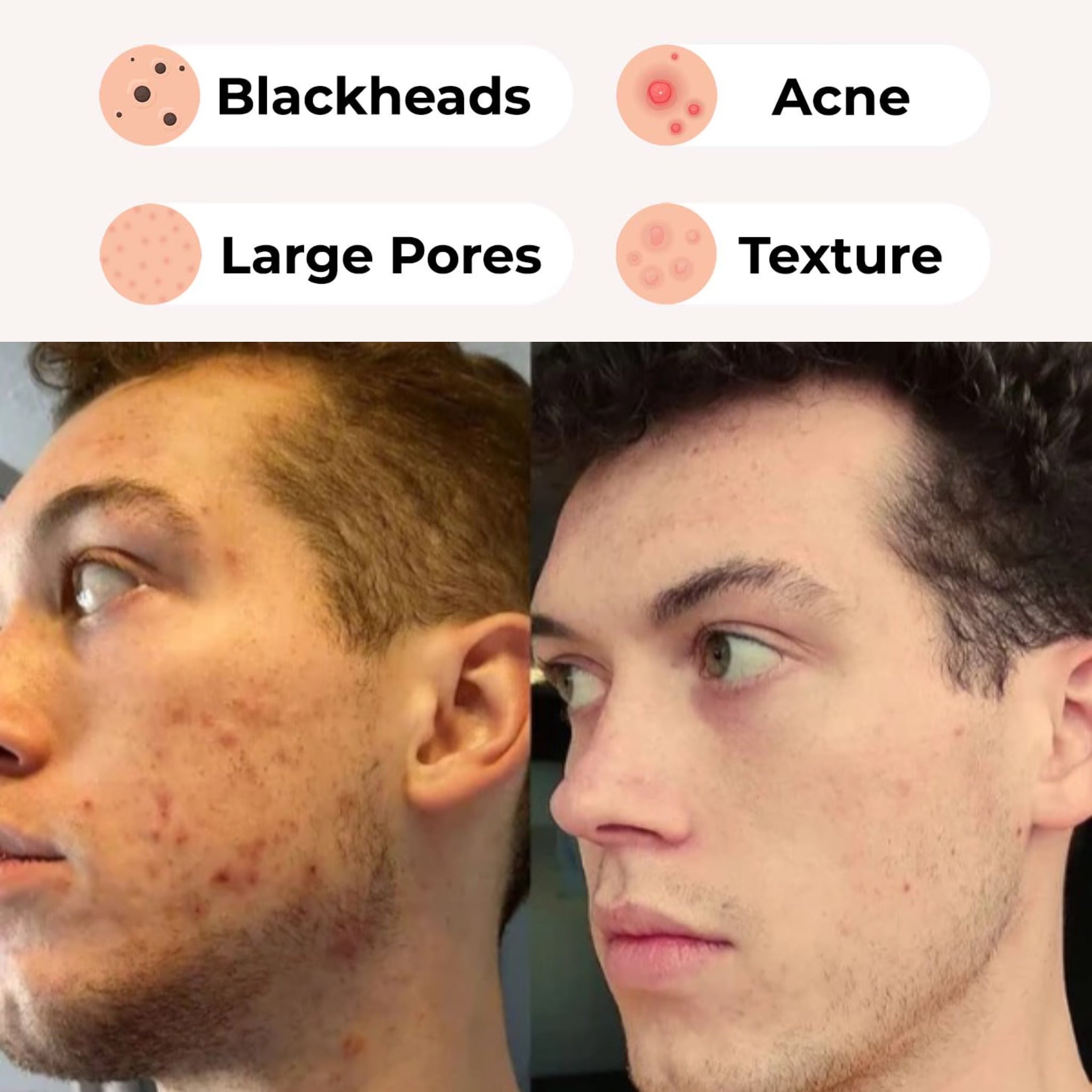 Volcano Pore Clay Stick